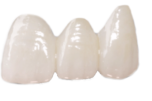 layered zirconia edit