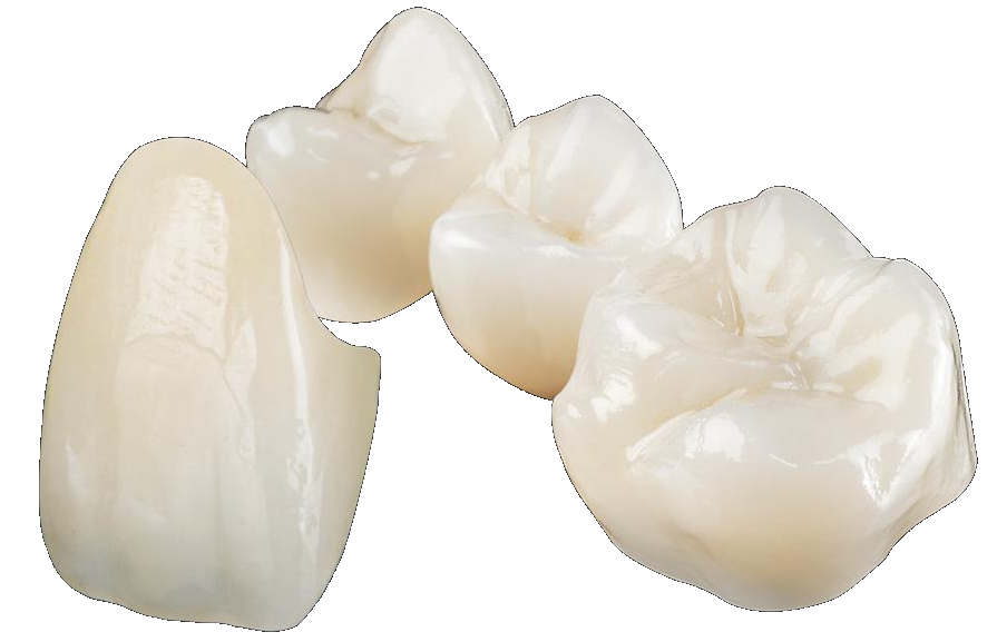 Emax or Zirconia HiTec Dental Ceramics