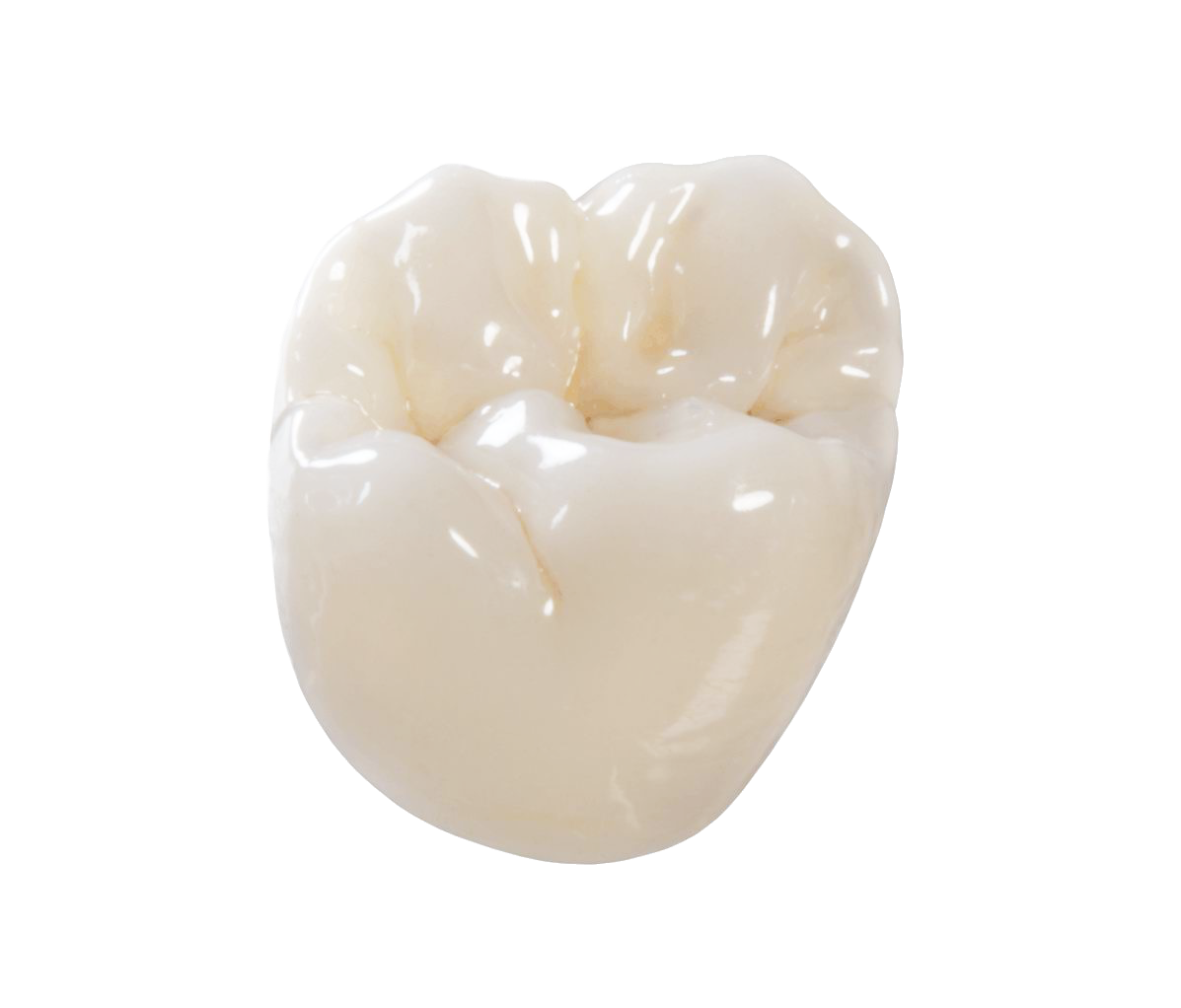 FAQ: PFM or Zirconia? – HiTec Dental Ceramics